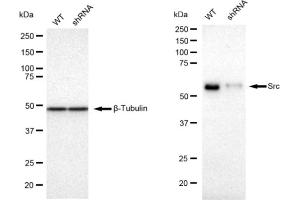 Western blotting analysis using Src antibody (ABIN7800055). (Recombinant Src 抗体)