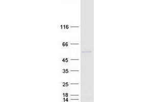 Validation with Western Blot