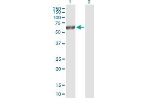Western Blot analysis of CAMK2G expression in transfected 293T cell line by CAMK2G MaxPab polyclonal antibody. (CAMKII gamma 抗体  (AA 1-527))