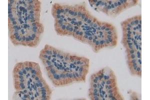 Detection of IGFBP5 in Mouse Small intestine Tissue using Polyclonal Antibody to Insulin Like Growth Factor Binding Protein 5 (IGFBP5) (IGFBP5 抗体  (AA 25-271))
