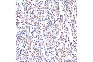 Immunohistochemistry of paraffin-embedded human tonsil using ZMYM3 antibody (ABIN6128940, ABIN6150453, ABIN6150454 and ABIN6216809) at dilution of 1:100 (40x lens). (ZMYM3 抗体  (AA 140-300))