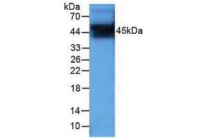 Detection of PIM1 in Human PC-3 cells using Polyclonal Antibody to Pim-1 Oncogene (PIM1) (PIM1 抗体  (AA 129-268))
