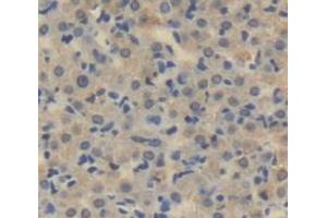 IHC-P analysis of Human Tissue, with DAB staining. (LOXL3 抗体  (AA 519-726))