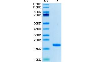 IL-18 Protein (AA 37-193) (Biotin)