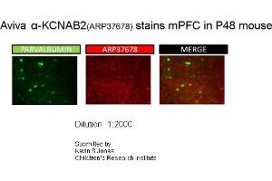 Sample Type: P48 MouseDilution: 1:2000 (KCNAB2 抗体  (Middle Region))