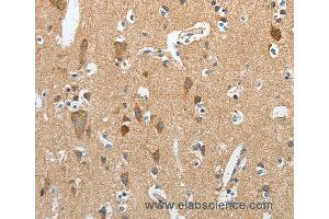 Immunohistochemistry of Human brain  using RCAN1 Polyclonal Antibody at dilution of 1:45 (RCAN1 抗体)