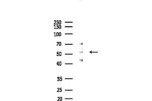 anti-UDP-Glucose 6-Dehydrogenase (UGDH) (C-Term) antibody