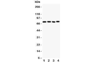 Western blot testing of Tec antbody; Lane 1: rat liver;  2: (r) spleen;  3: (r) kidney;  4: human HeLa;  5: (h) Jurkat cell lysate. (NR4A3 抗体  (AA 612-631))