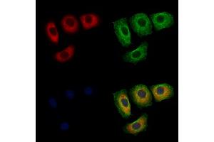 ABIN6256515 and ABIN6267566 staining Hela cells(4h of LPS treatment) by IF/ICC. (14-3-3 zeta 抗体  (pThr232))