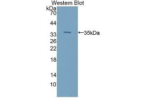 Western blot analysis of the recombinant protein. (ILK 抗体  (AA 183-452))