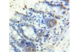 Immunohistochemistry (IHC) image for anti-High Mobility Group AT-Hook 1 (HMGA1) (AA 1-107) antibody (ABIN1078143)