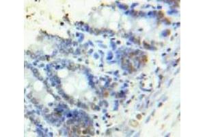 Used in DAB staining on fromalin fixed paraffin-embedded Bowels tissue (HMGA1 抗体  (AA 1-107))