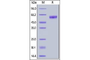SDS-PAGE (SDS) image for Killer Cell Lectin-Like Receptor Subfamily C, Member 1 (KLRC1) (AA 94-233) protein (Fc Tag) (ABIN6938836)