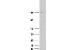 Western Blotting (WB) image for Block of Proliferation 1 (BOP1) protein (Myc-DYKDDDDK Tag) (ABIN2715320)