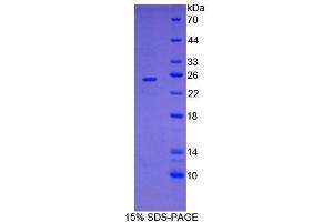 SDS-PAGE analysis of Mouse FOLR4 Protein. (Folate Receptor 4 蛋白)