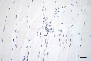 Immunohistochemistry was performed on paraffin-embedded mouse skeletal muscle using AKAP8 antibody (ABIN7797435), 1:200). (AKAP8 抗体)