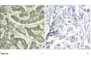 Image no. 1 for anti-Ataxia Telangiectasia and Rad3 Related (ATR) (Ser428) antibody (ABIN319380) (ATR 抗体  (Ser428))