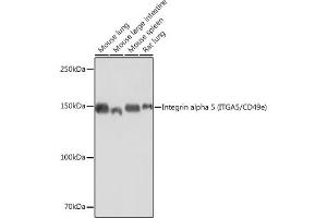 Western blot analysis of extracts of various cell lines, using Integrin alpha 5 (ITG/CD49e) (ITG/CD49e) antibody (ABIN7267936) at 1:1000 dilution. (ITGA5 抗体)
