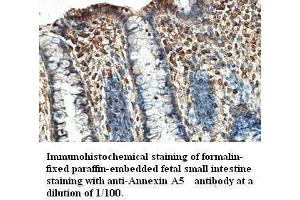 Image no. 1 for anti-Annexin A5 (ANXA5) antibody (ABIN791195) (Annexin V 抗体)