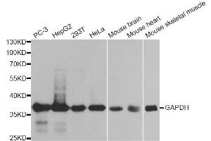 Western blot analysis of extracts of various cell lines, using GAPDH antibody. (GAPDH 抗体  (AA 1-335))