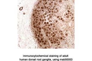 Image no. 1 for anti-Neurofibromin 1 (NF1) (N-Term) antibody (ABIN363207) (Neurofibromin 1 抗体  (N-Term))