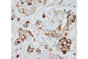 Image no. 1 for anti-S-Phase Kinase-Associated Protein 2 (SKP2) (N-Term) antibody (ABIN1495043) (SKP2 抗体  (N-Term))