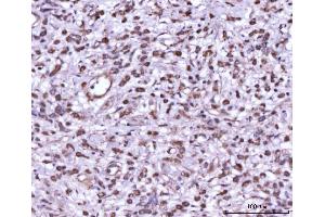 IHC analysis of MEK7/MAP2K7 using anti-MEK7/MAP2K7 antibody (ABIN3043875). (MAP2K7 抗体  (N-Term))