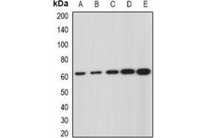 Western blot analysis of GNS expression in SKOV3 (A), Hela (B), mouse liver (C), mouse kidney (D), rat brain (E) whole cell lysates. (GNS 抗体)