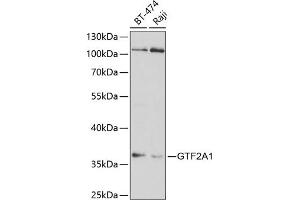 Western blot analysis of extracts of various cell lines, using GTF2 antibody (ABIN6128820, ABIN6141488, ABIN6141489 and ABIN6220980) at 1:1000 dilution. (GTF2A1 抗体  (AA 1-270))