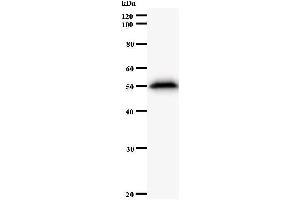 Western Blotting (WB) image for anti-AT Rich Interactive Domain 3A (BRIGHT-Like) (ARID3A) antibody (ABIN930938) (ARID3A 抗体)