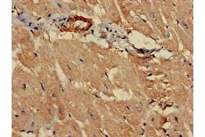Immunohistochemistry of paraffin-embedded human heart tissue using ABIN7164812 at dilution of 1:100 (PCCA 抗体  (AA 585-720))