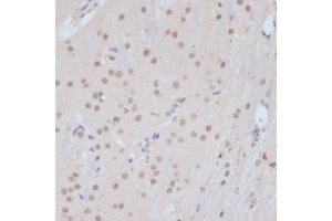 Immunohistochemistry (IHC) image for anti-Cyclin-Dependent Kinase 9 (CDK9) (AA 153-372) antibody (ABIN6138331)