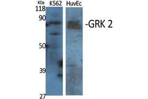 Western Blot (WB) analysis of specific cells using GRK 2 Polyclonal Antibody.