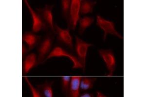 Immunofluorescence analysis of U2OS cells using PSMB4 Polyclonal Antibody (PSMB4 抗体)
