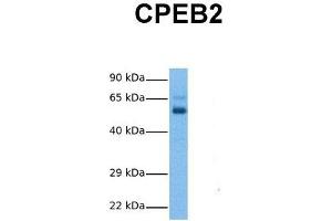 Host:  Rabbit  Target Name:  CPEB2  Sample Tissue:  Human Ovary Tumor  Antibody Dilution:  1. (CPEB2 抗体  (Middle Region))