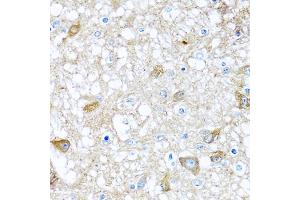 Immunohistochemistry of paraffin-embedded rat brain using BMP5 antibody (ABIN5974675) at dilution of 1/100 (40x lens). (BMP5 抗体)