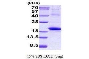 Figure annotation denotes ug of protein loaded and % gel used. (IL18BP 蛋白)