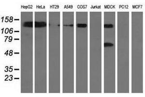 Image no. 2 for anti-L1 Cell Adhesion Molecule (L1CAM) antibody (ABIN1499086) (L1CAM 抗体)