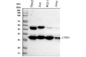 Western blot analysis of CTSD using anti-CTSD antibody (ABIN3044509). (Cathepsin D 抗体  (AA 201-412))