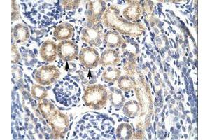 Image no. 1 for anti-Kv Channel Interacting Protein 3, Calsenilin (KCNIP3) (AA 70-119) antibody (ABIN6736266) (DREAM 抗体  (AA 70-119))