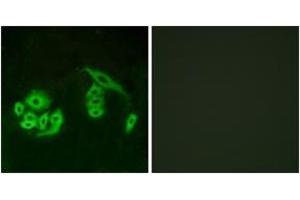 Immunofluorescence analysis of A549 cells, using GPR12 Antibody. (G Protein-Coupled Receptor 12 抗体  (AA 1-50))