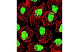Fluorescent confocal image of U251 cell stained wit. (Nucleolin 抗体  (AA 276-304))