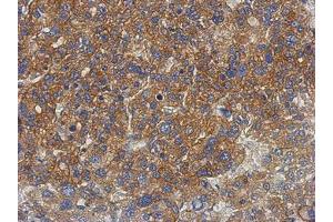 Image no. 1 for anti-Patatin-Like phospholipase Domain Containing 4 (PNPLA4) (AA 1-249) antibody (ABIN1500317) (PNPLA4 抗体  (AA 1-249))