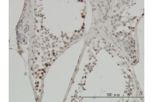 Immunoperoxidase of monoclonal antibody to MYC on formalin-fixed paraffin-embedded human testis. (c-MYC 抗体  (AA 330-439))