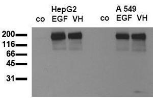 Western Blotting (WB) image for anti-Epidermal Growth Factor Receptor (EGFR) (pTyr869) antibody (ABIN126761) (EGFR 抗体  (pTyr869))