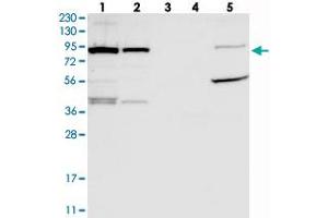 Western blot analysis of Lane 1: RT-4, Lane 2: U-251 MG, Lane 3: Human Plasma, Lane 4: Liver, Lane 5: Tonsil with UFL1 polyclonal antibody  at 1:250-1:500 dilution. (UFL1 抗体)