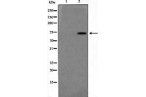 Western blot analysis on Jurkat cell lysate using DUSP16 Antibody,The lane on the left is treated with the antigen-specific peptide. (DUSP16 抗体  (Internal Region))