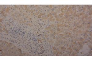 Detection of TF in Human Liver Tissue using Polyclonal Antibody to Transferrin (TF) (Transferrin 抗体  (AA 361-683))