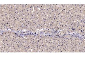 Detection of CD73 in Human Liver Tissue using Monoclonal Antibody to Cluster Of Differentiation 73 (CD73) (CD73 抗体  (AA 29-500))