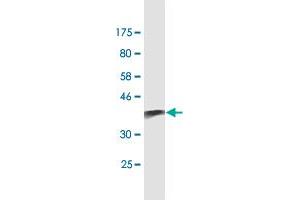 Western Blot detection against Immunogen (38. (S100A9 抗体  (AA 1-114))